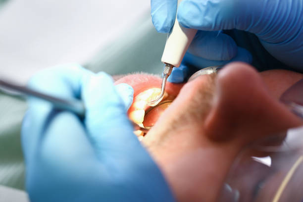 Best Orthodontic Emergency Dentist in Yale, MI