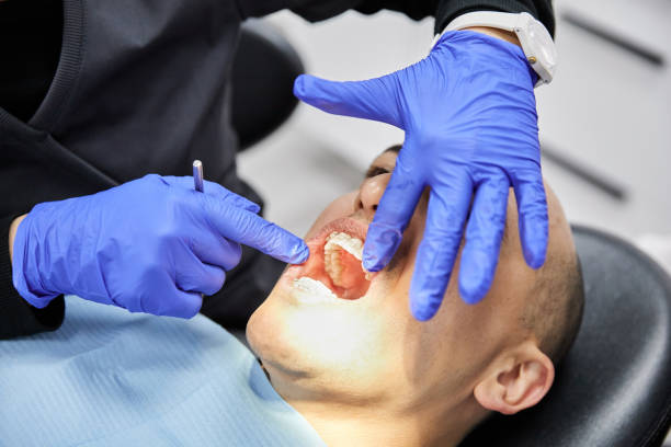 Best Emergency Dental Extractions in Yale, MI